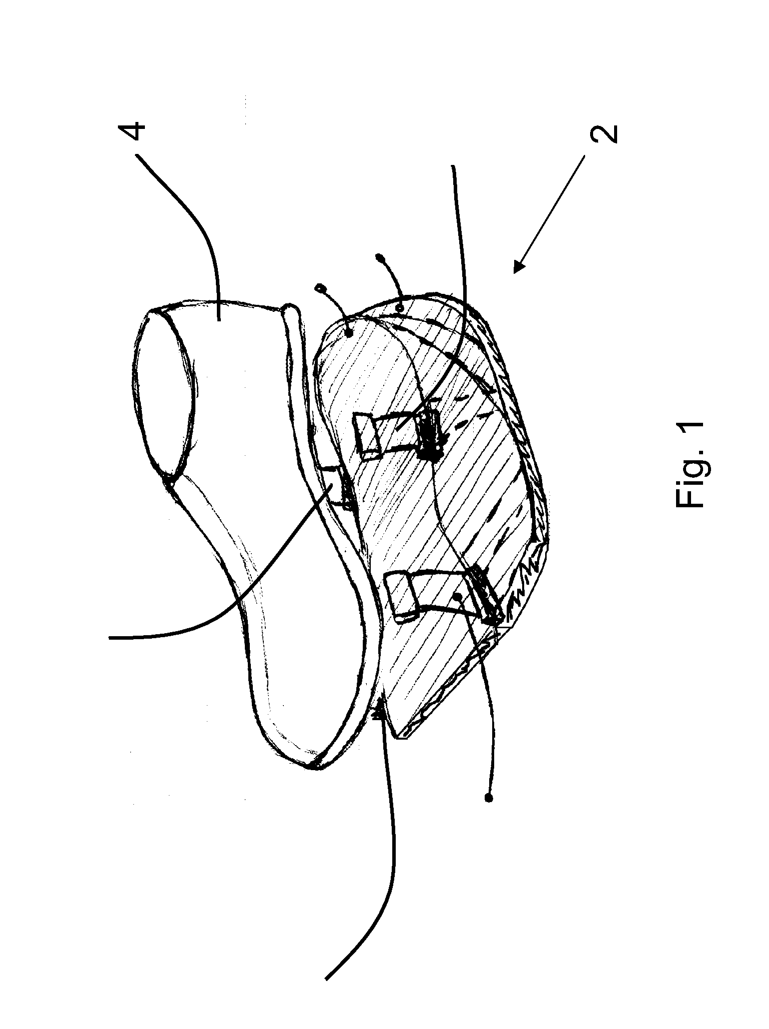 Stabiliser Assembly