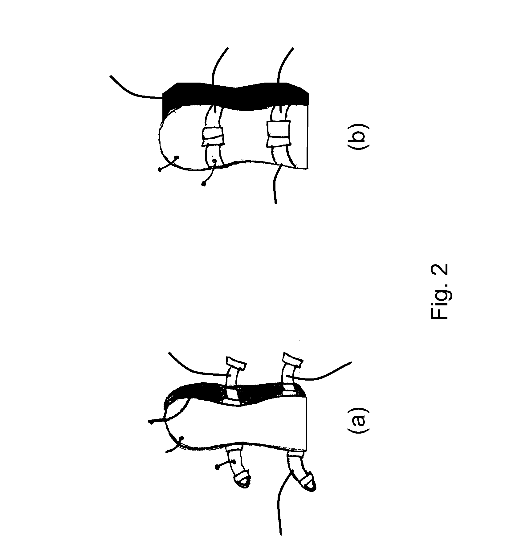 Stabiliser Assembly