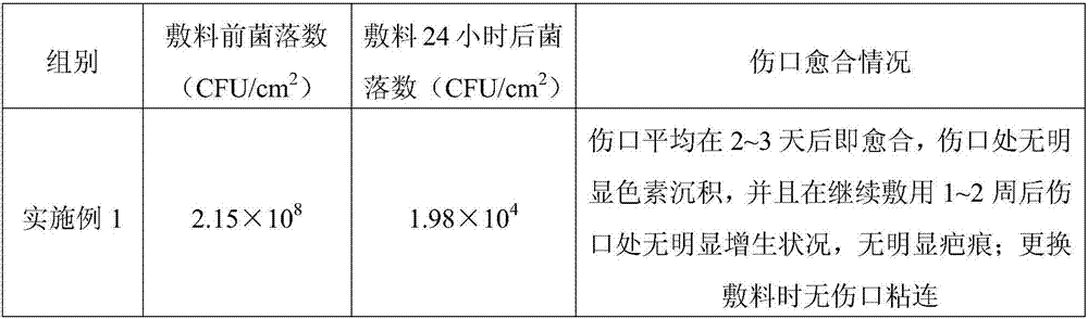 Alginate medical dressing and preparation method thereof