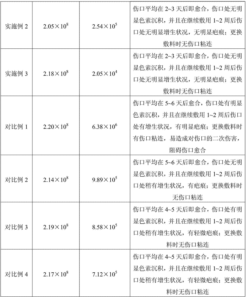 Alginate medical dressing and preparation method thereof