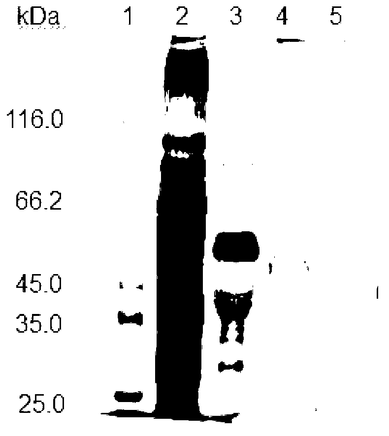 Strain capable of producing carboxyethylhydantoinase and application thereof