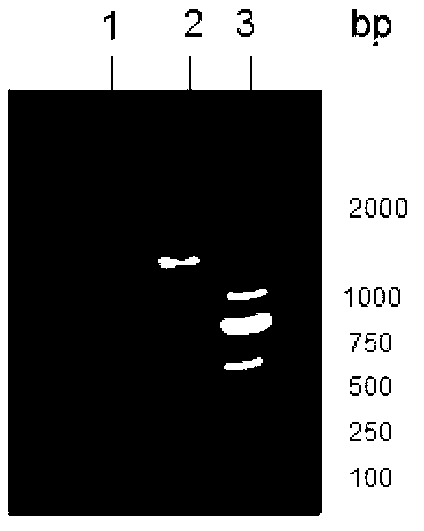 Strain capable of producing carboxyethylhydantoinase and application thereof