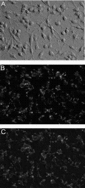 Recombinant fusion protein PTD-HSP27 and use thereof