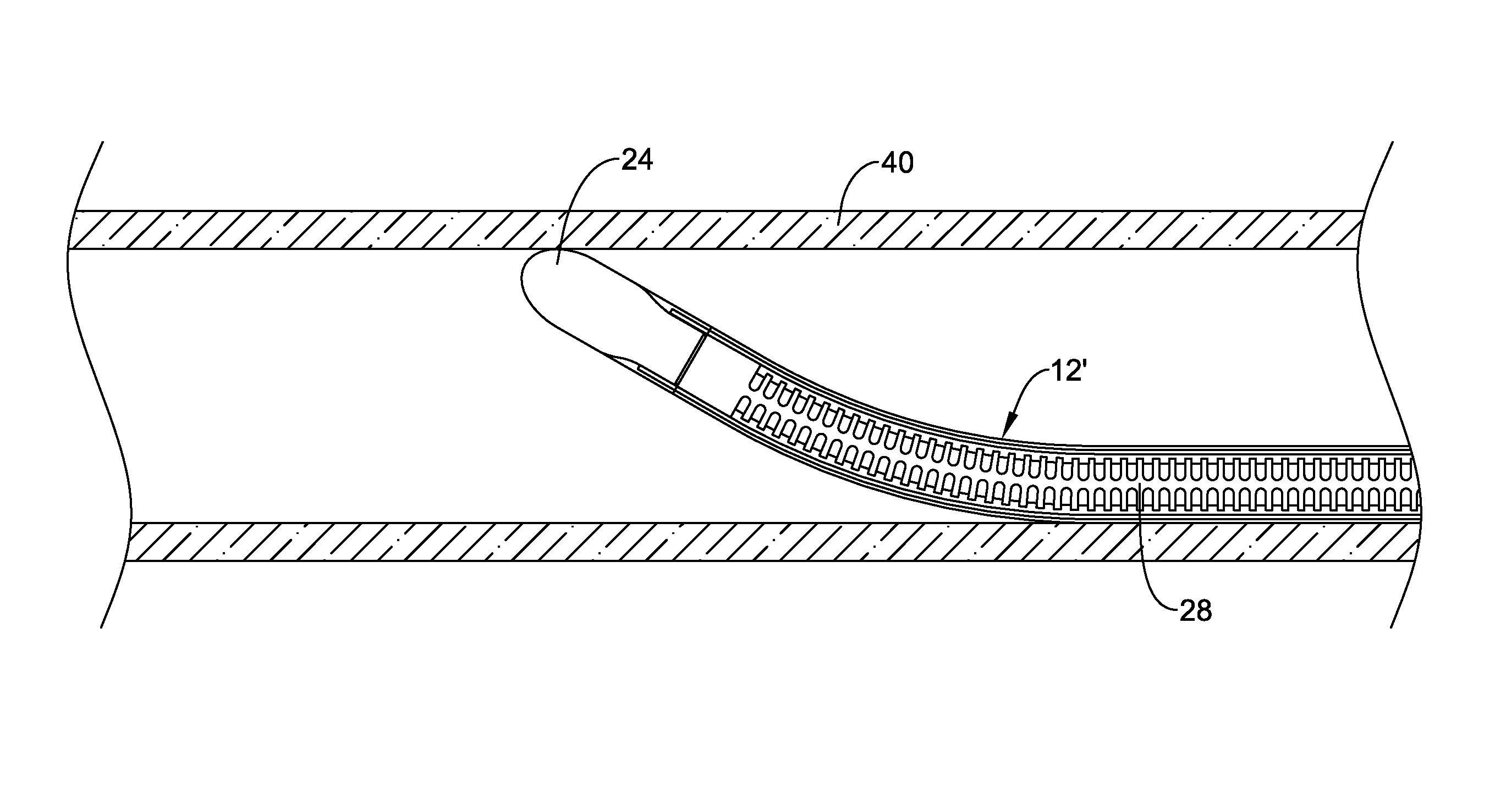 Deflectable medical devices