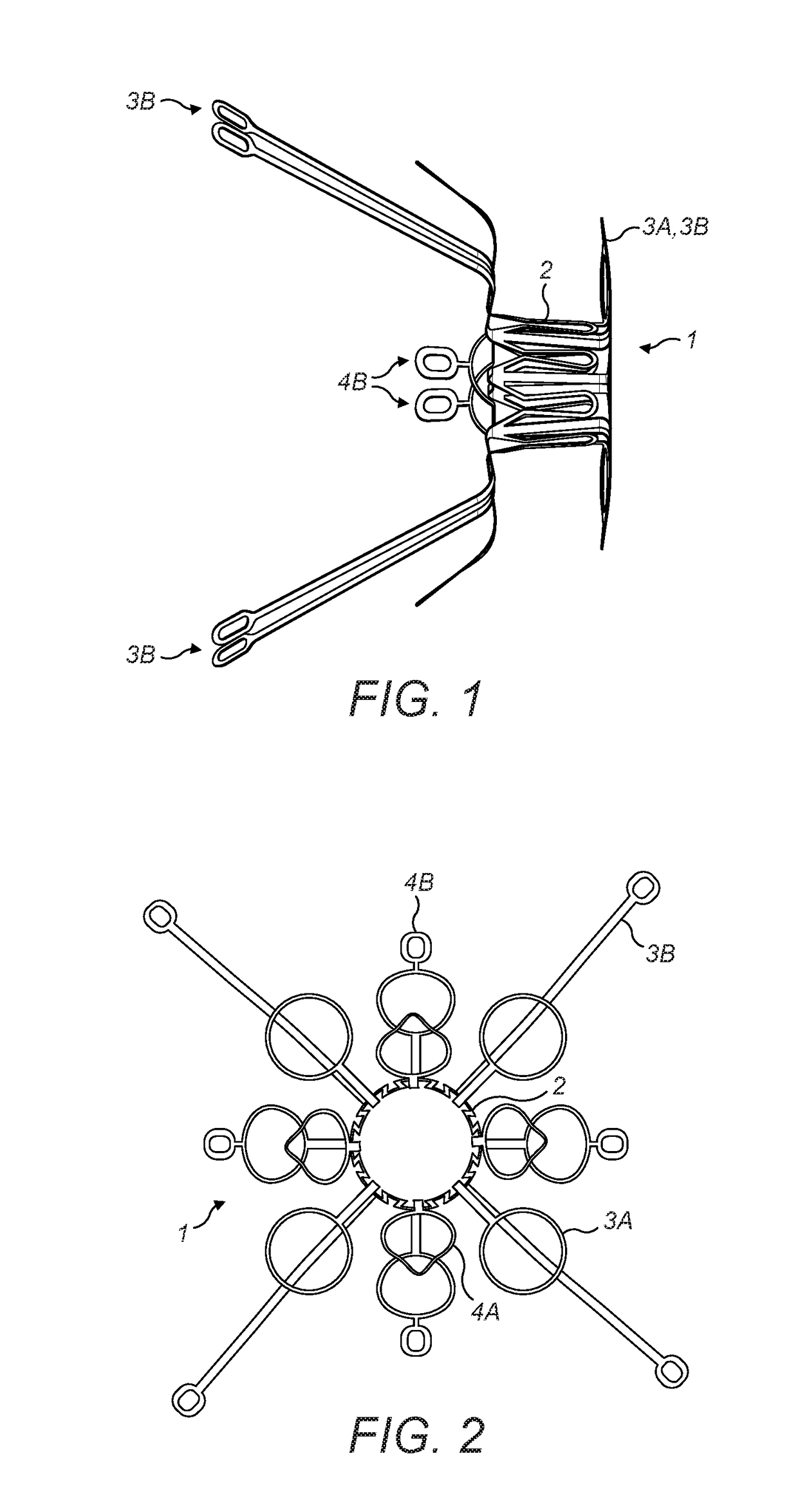 Method for coupling anatomical walls using a connector