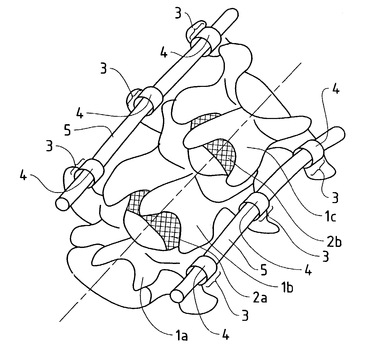 Elastic stabilization system for vertebral columns