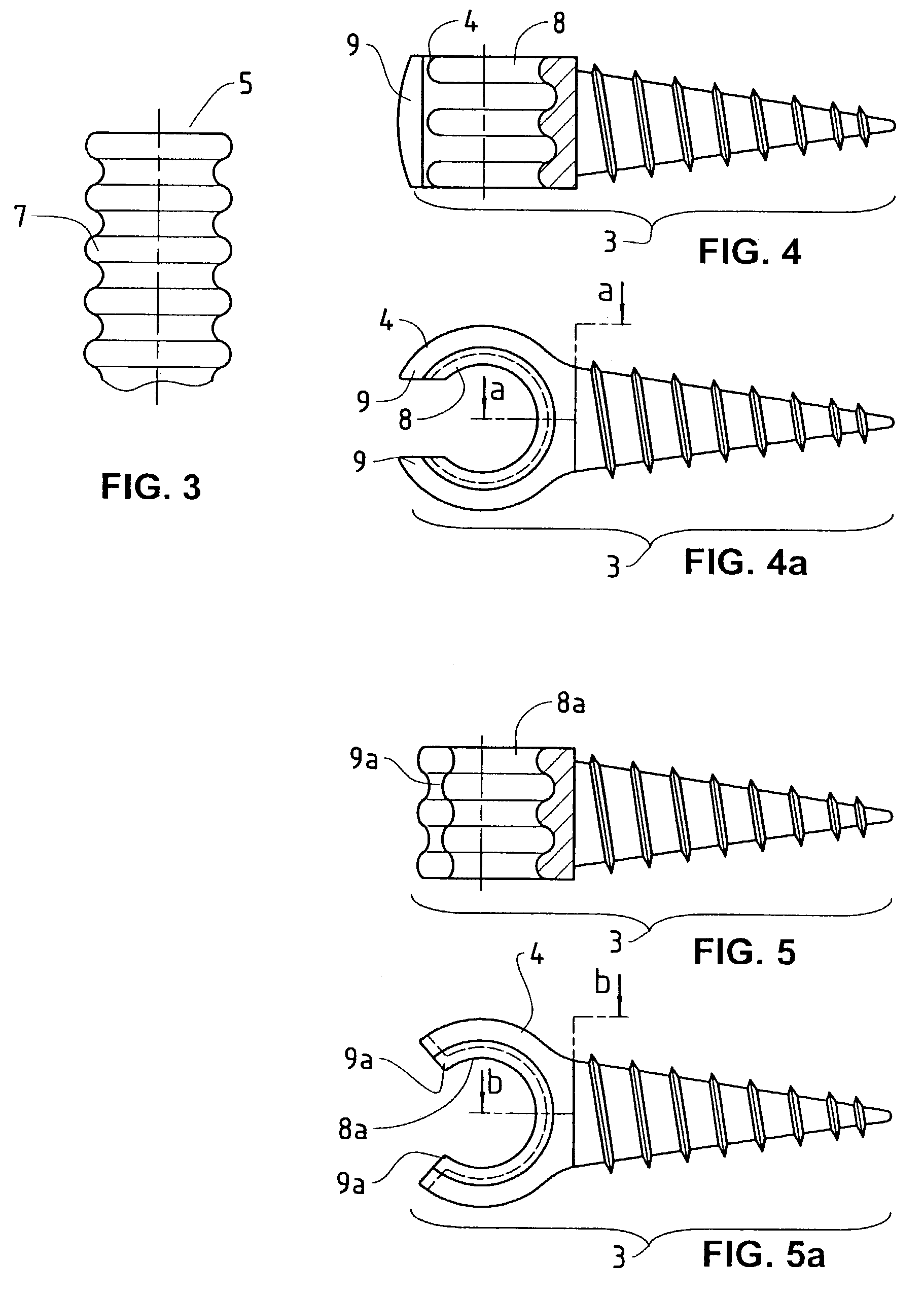 Elastic stabilization system for vertebral columns