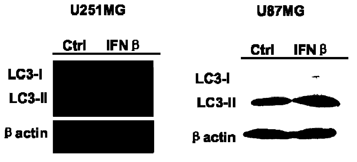 Synergic pharmaceutical composition treating tumors