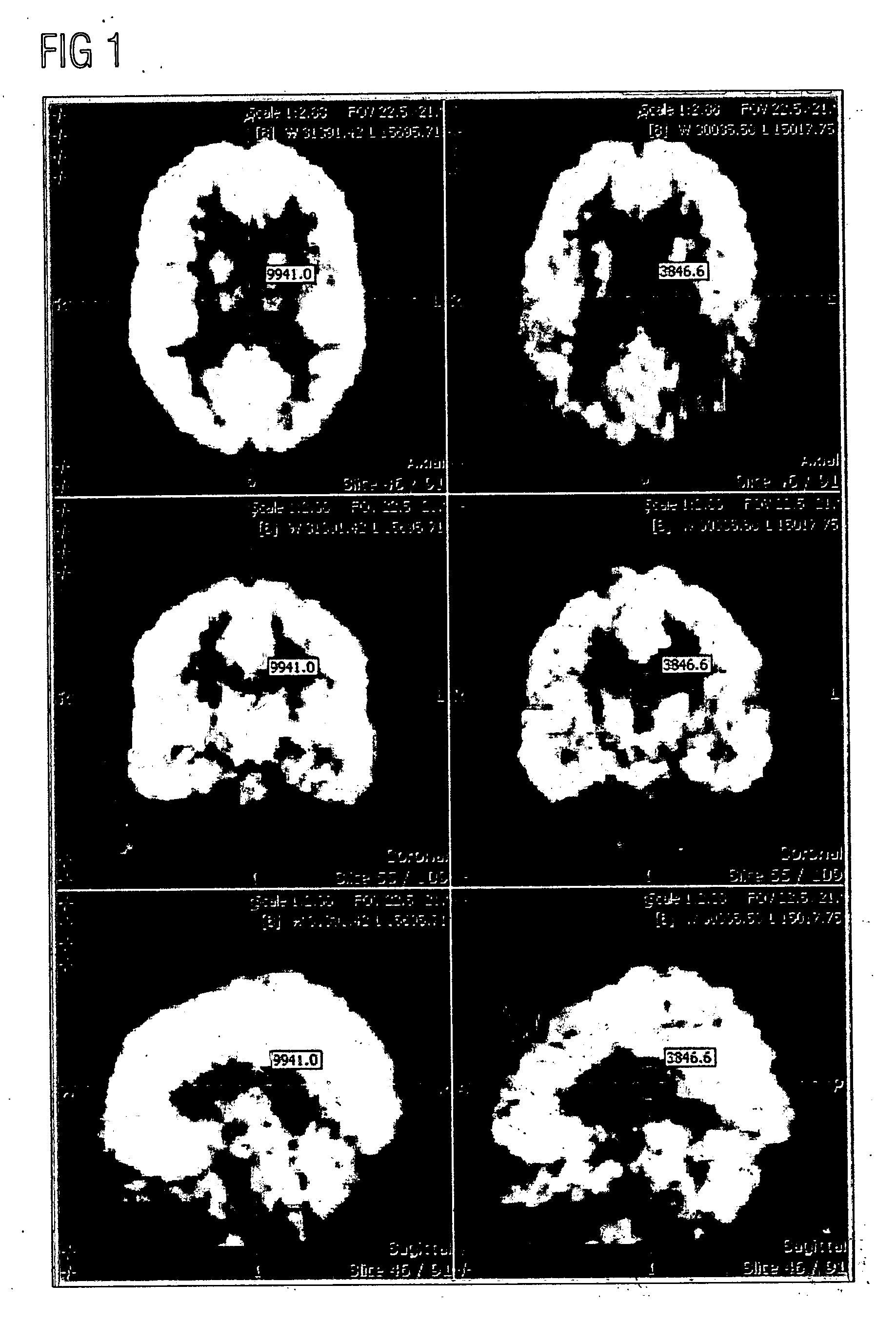 ROI-based assessment of abnormality using transformation invariant features