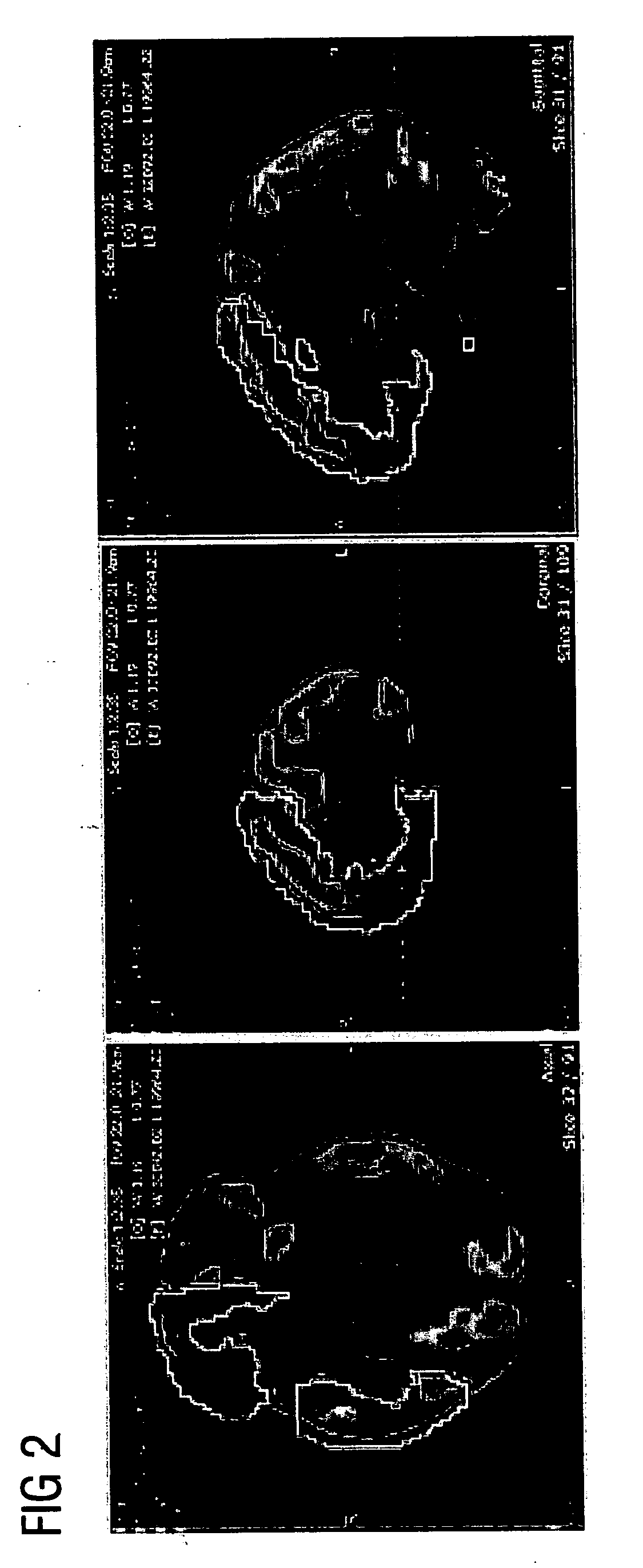 ROI-based assessment of abnormality using transformation invariant features