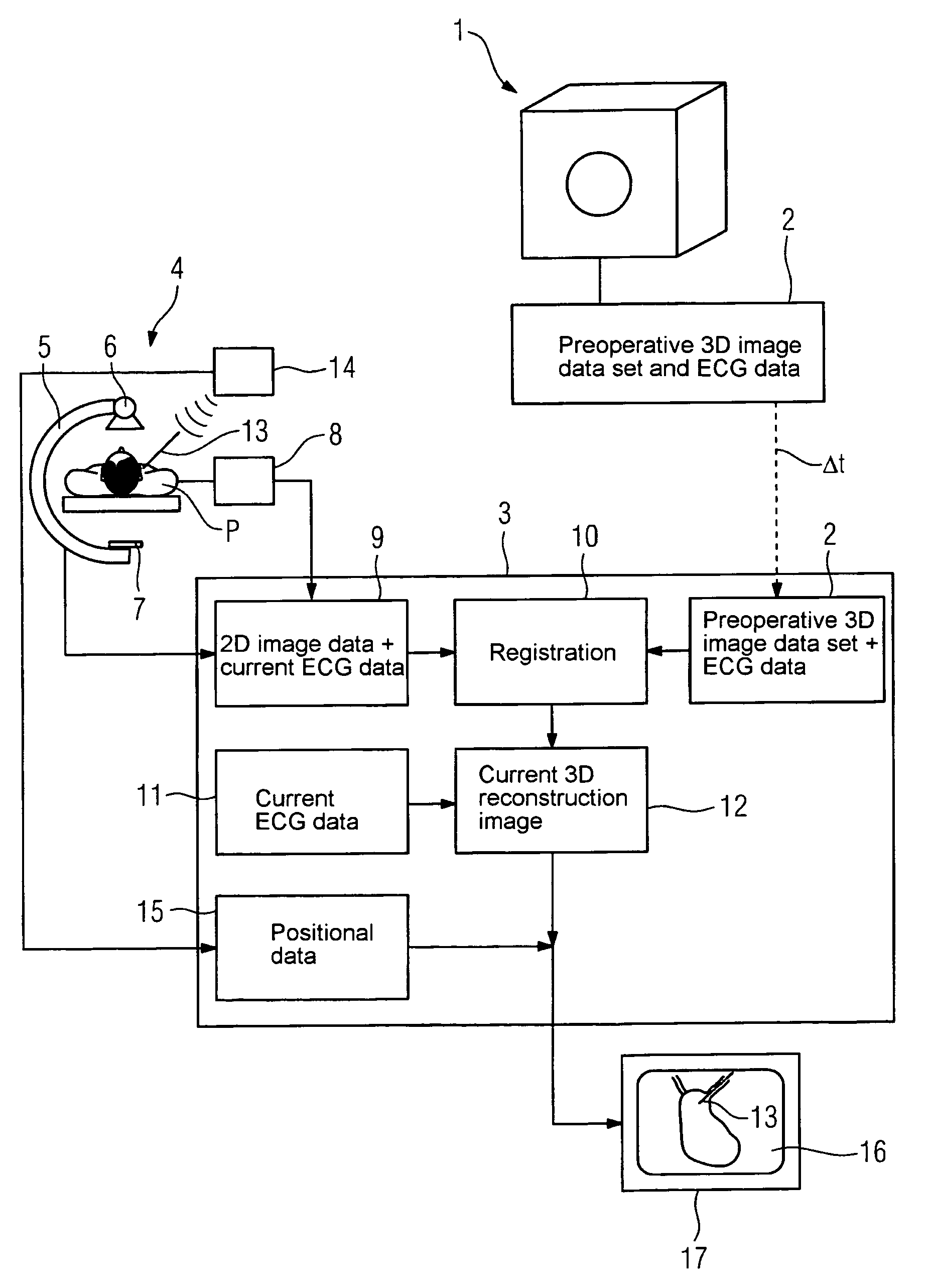 Method for medical imaging