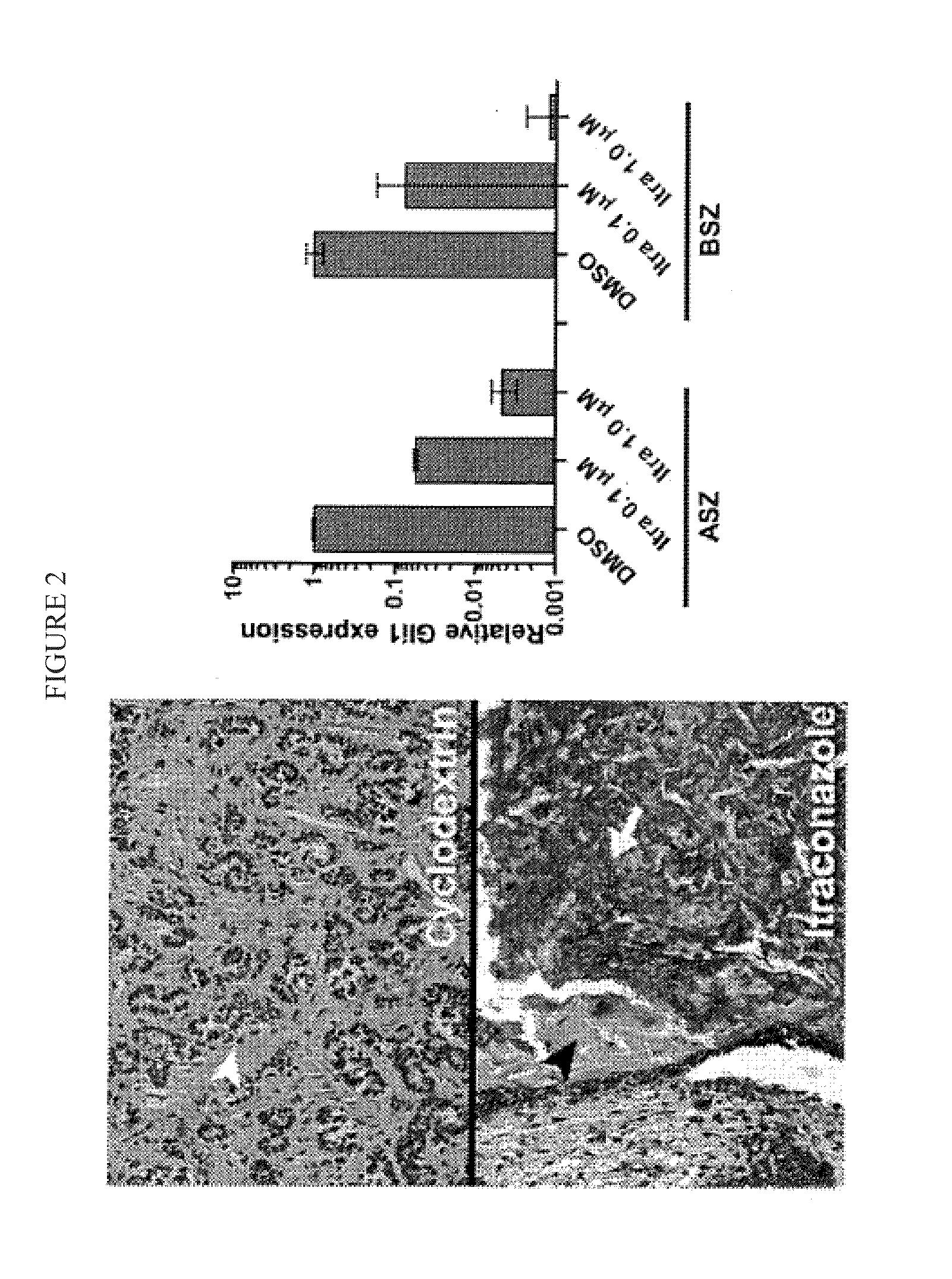 Topical Itraconazole Formulations and Uses Thereof