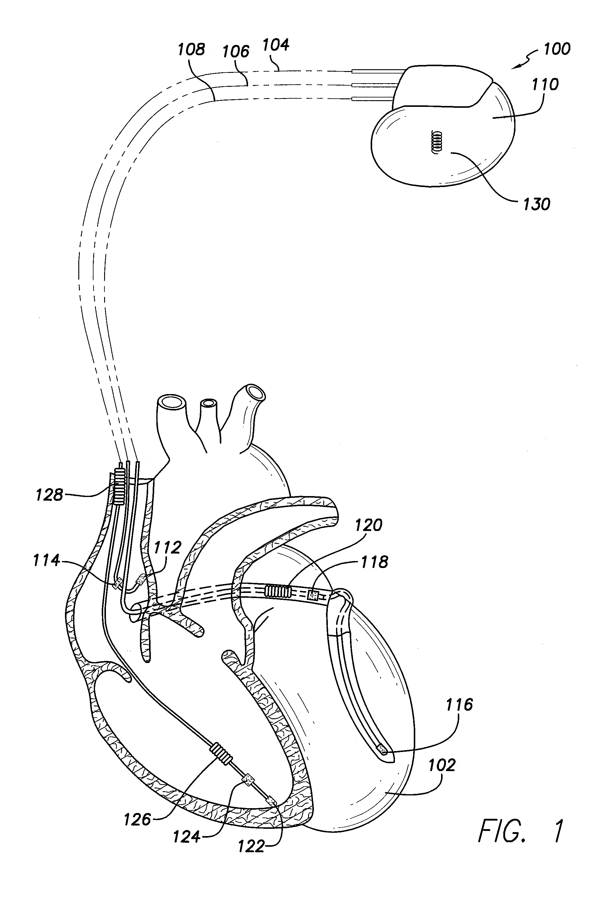 Method and system for sensing external magnetic fields using a multi-function coil of an implantable medical device