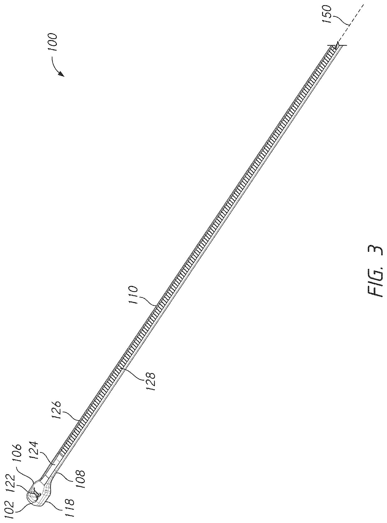 Bone tie and bone tie inserter