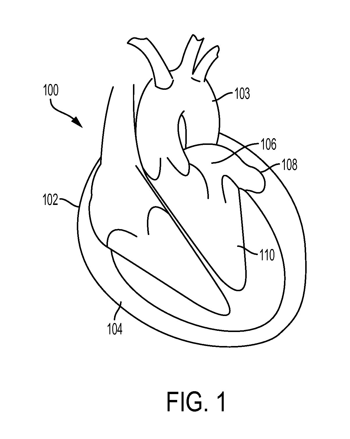 Pericardial access devices and methods