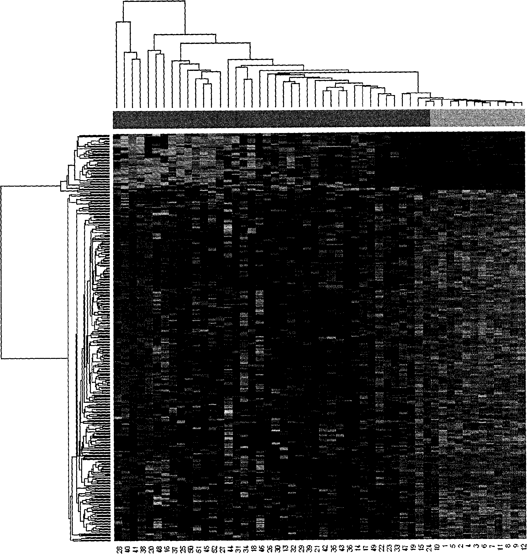 Method for the analysis of breast cancer disorders