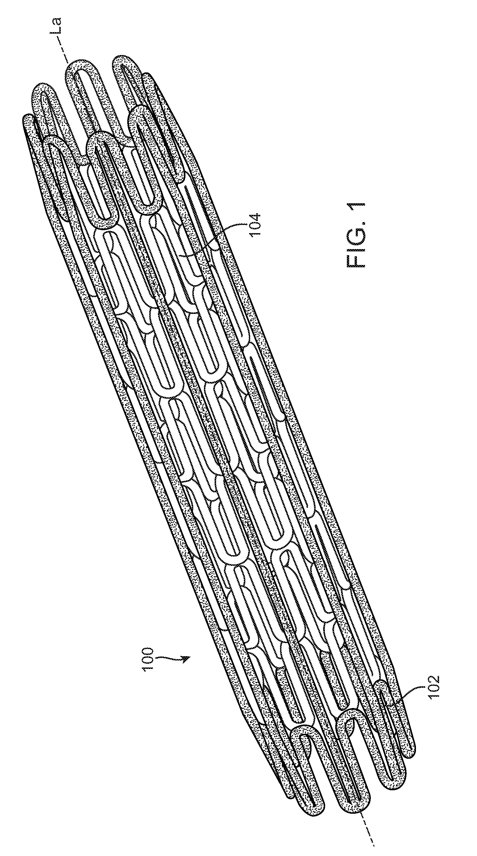 Double-walled stent system