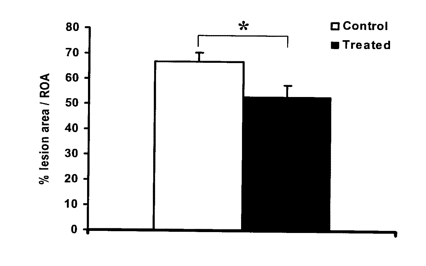 Method and compound for the treatment of valvular disease