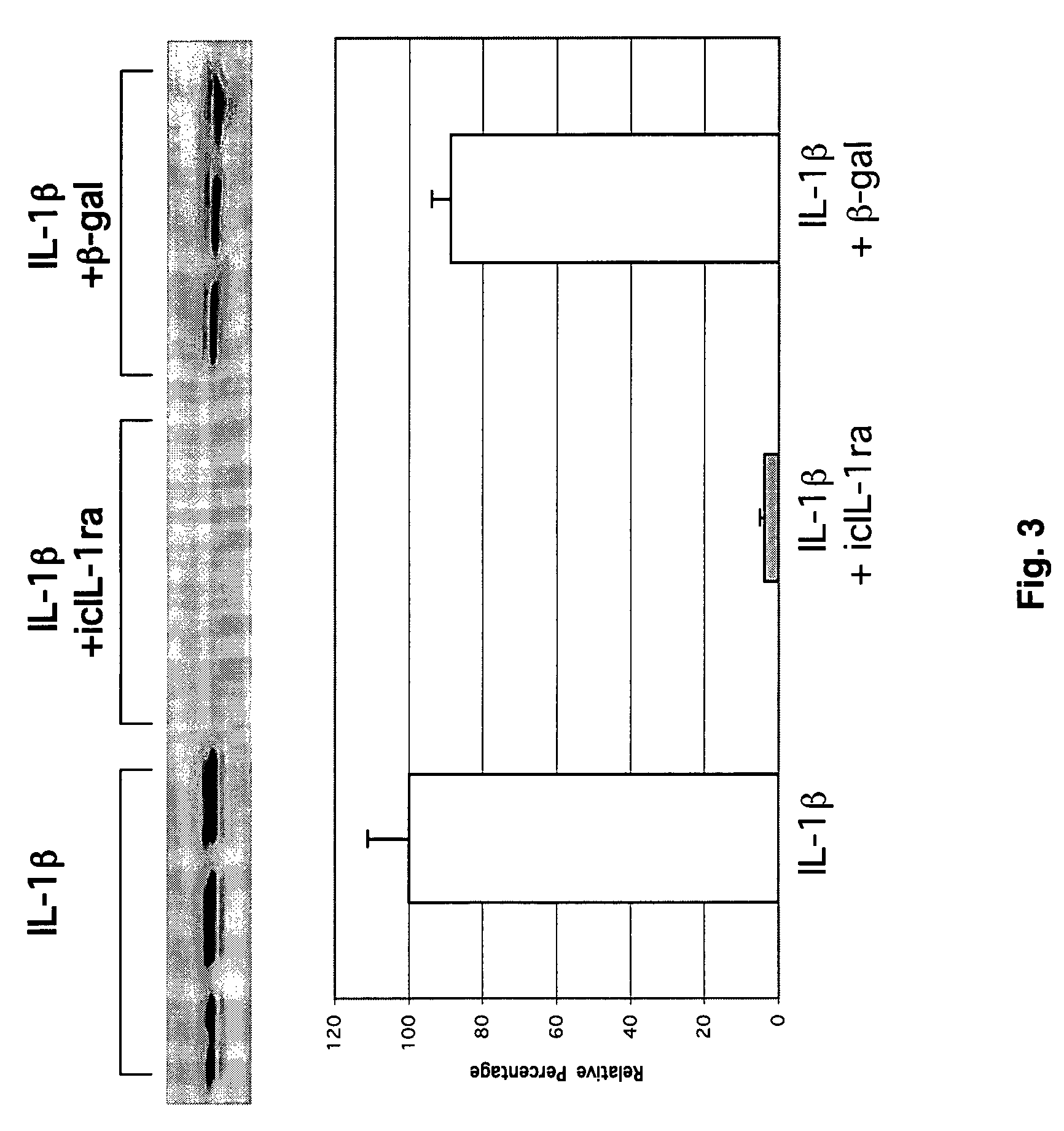 Intracellular interleukin-1 receptor antagonist and uses thereof