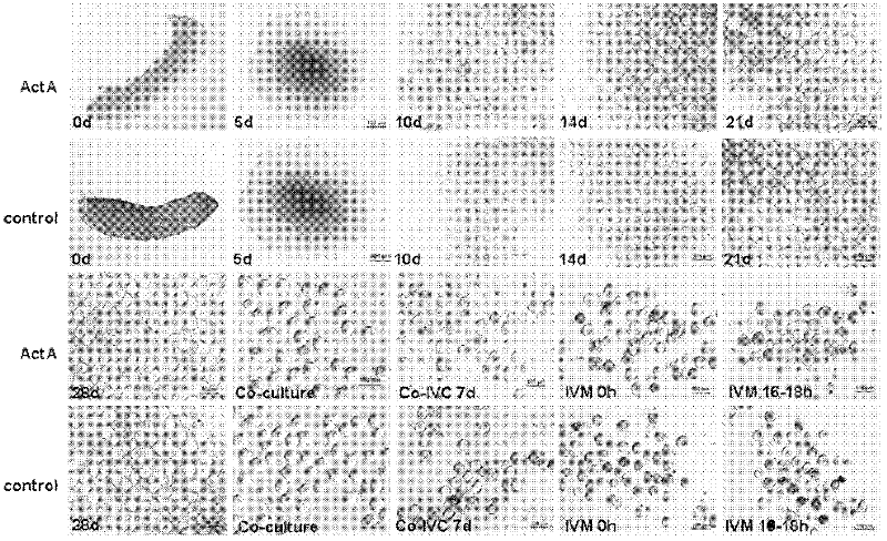 Technological method for promoting ectogenesis of premeiotic female germ cells by using activin A (ActA)