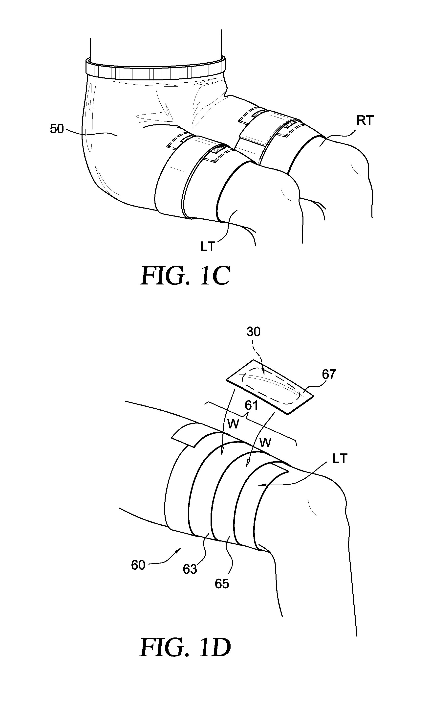 Apparatus for, and method of, reducing knee pain and/or increasing levels of athletic performance