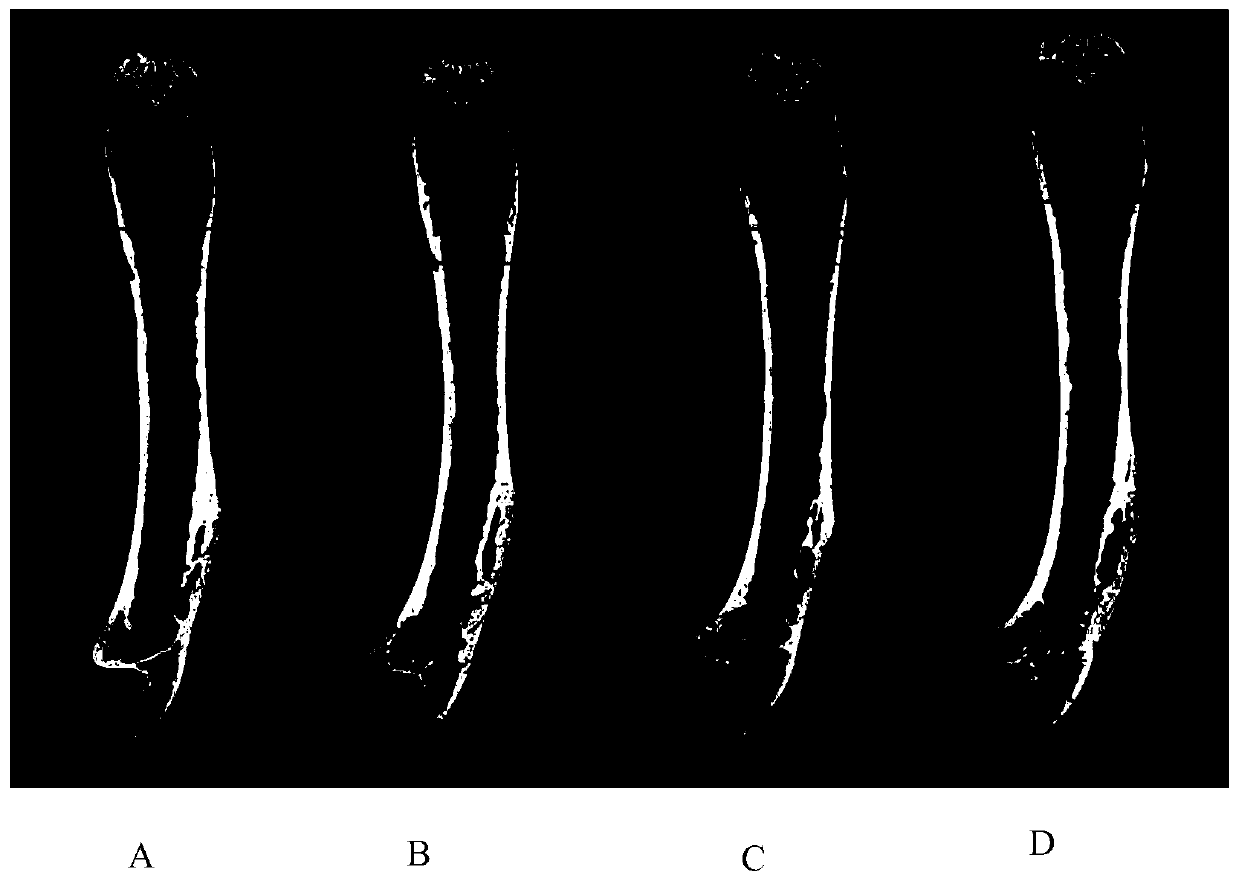 Application of lactulose to prevention or treatment of postmenopausal osteoporosis