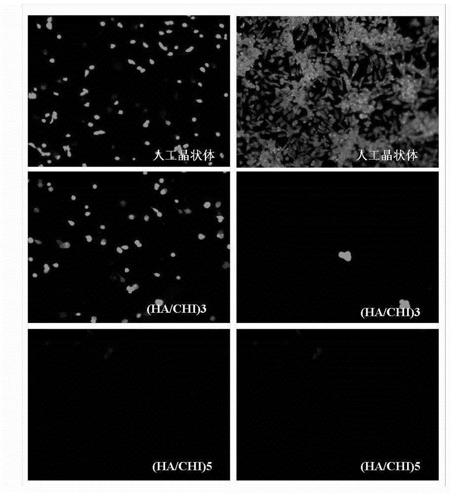 Modification process of surface bionic self-assembly multilayer film of artificial lens and artificial lens provided with surface bionic self-assembly multilayer film