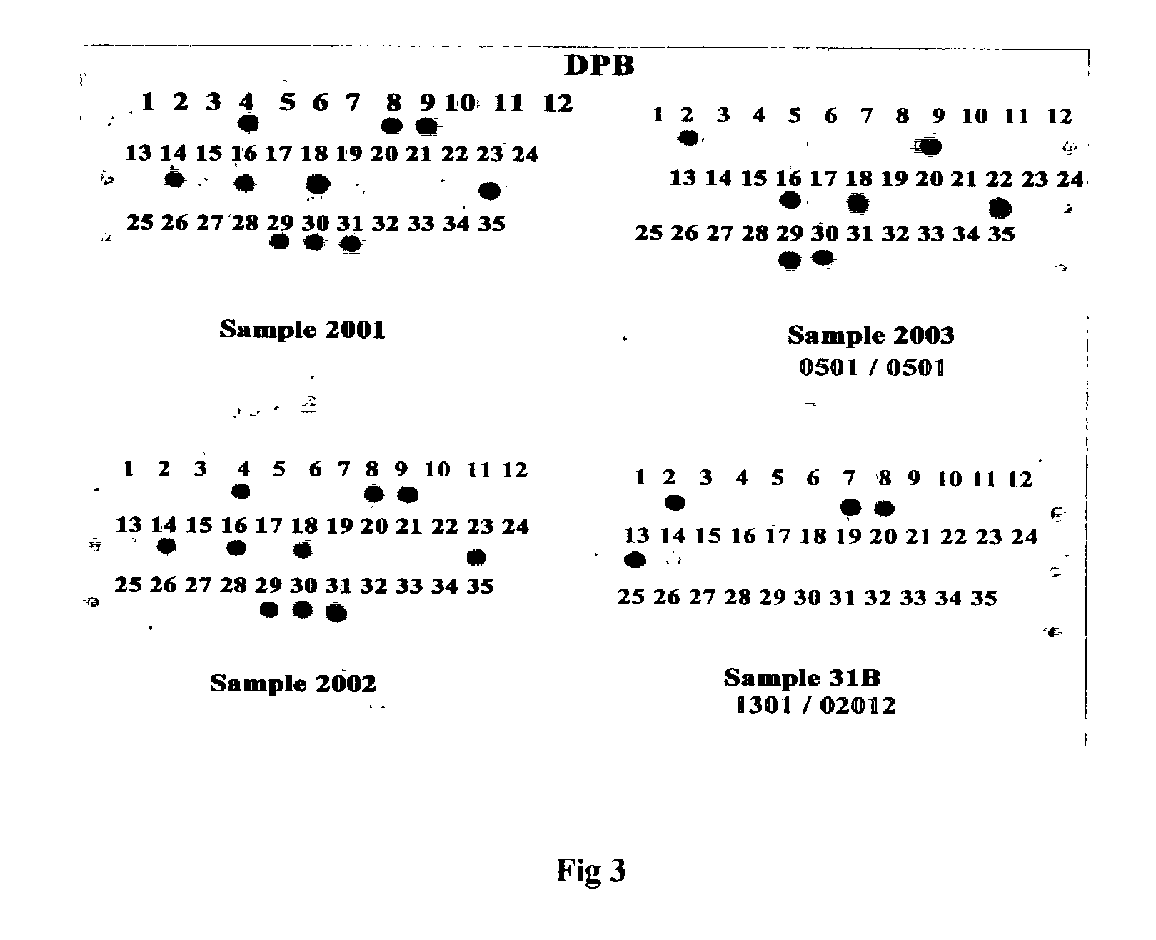 SNP-based HLA-DP, DR and DQ genotyping analysis by reversed dot blot flow through hybridization