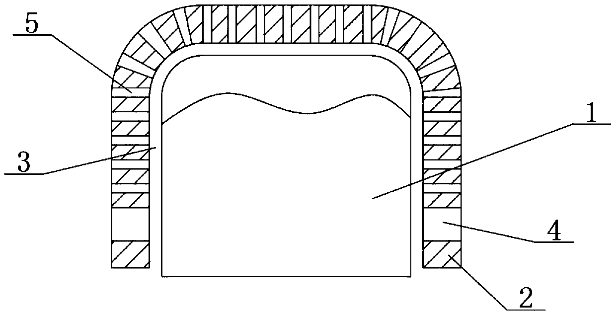 Titanium mesh implant with personalized alveolar bone augmentation generated by three-dimensional printing technology