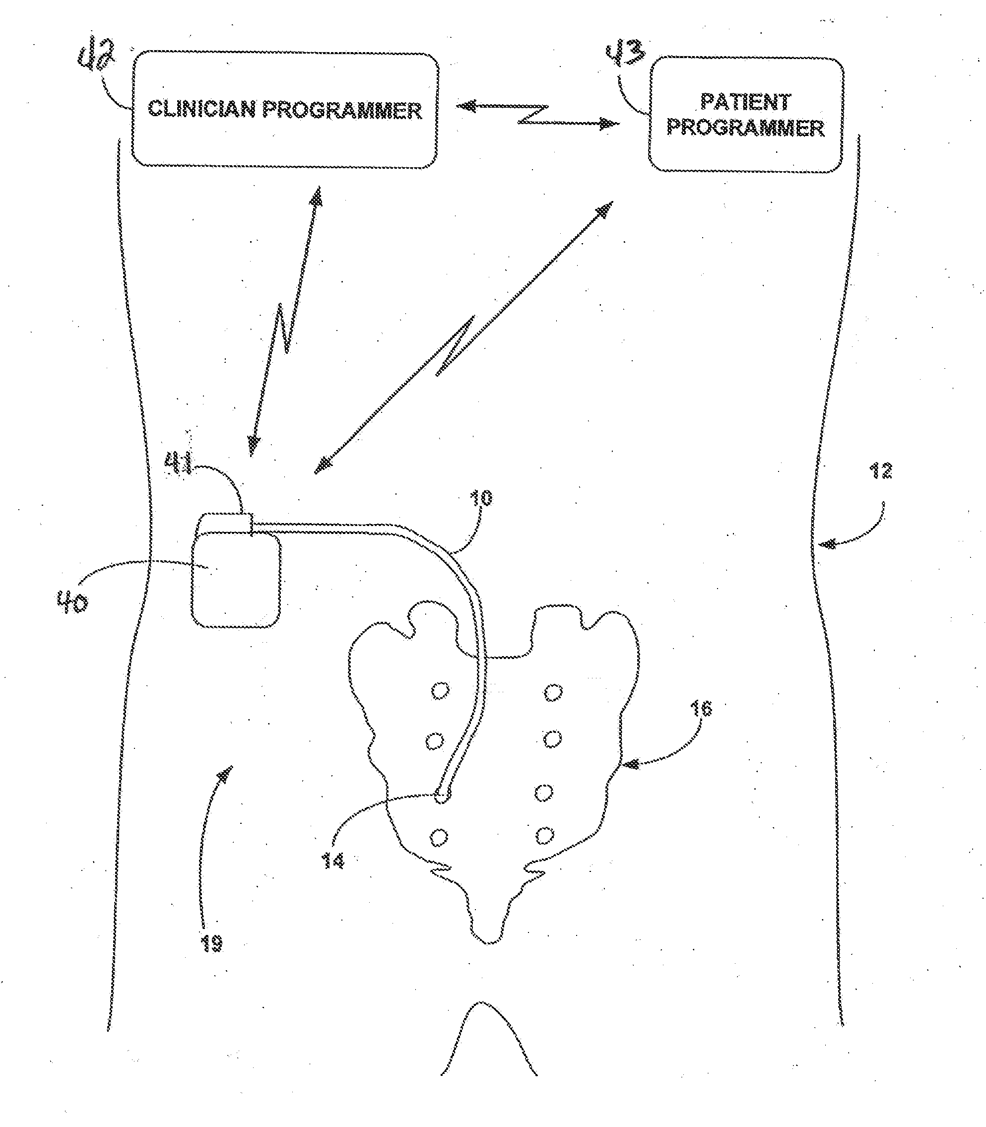 Implantable Medical Electrical Stimulation Lead Fixation Method and Apparatus