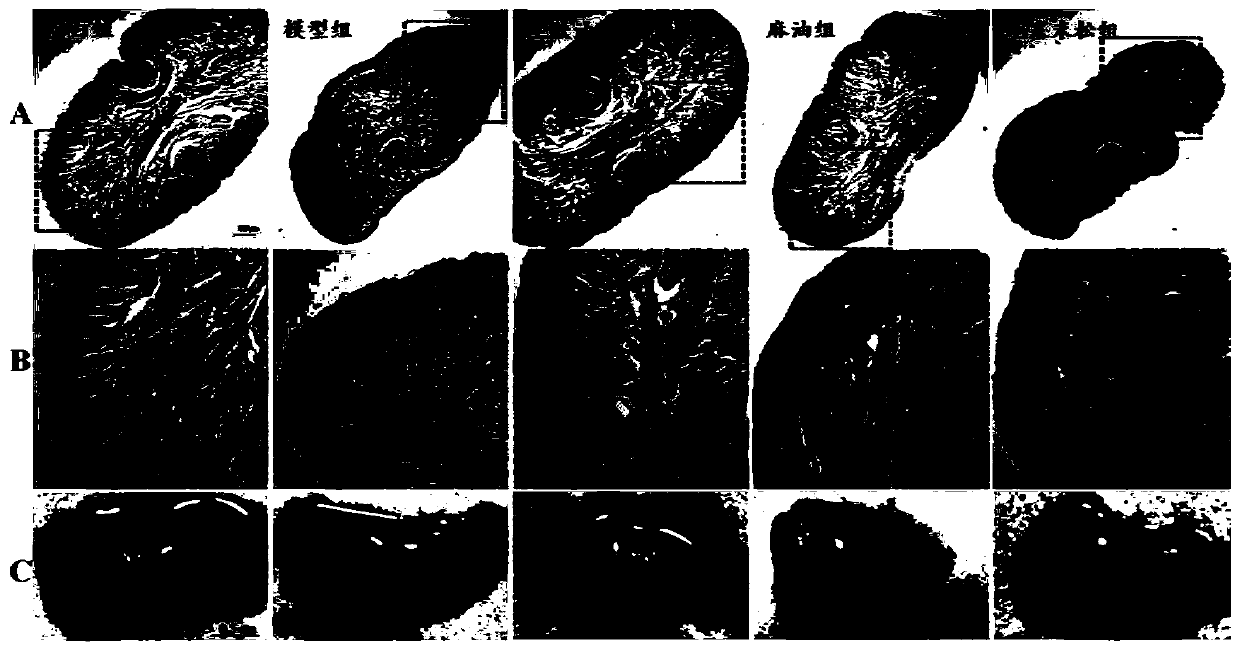 Oral skin regeneration promoting oil for treating oral cavity burn and scald and preparation method and application thereof