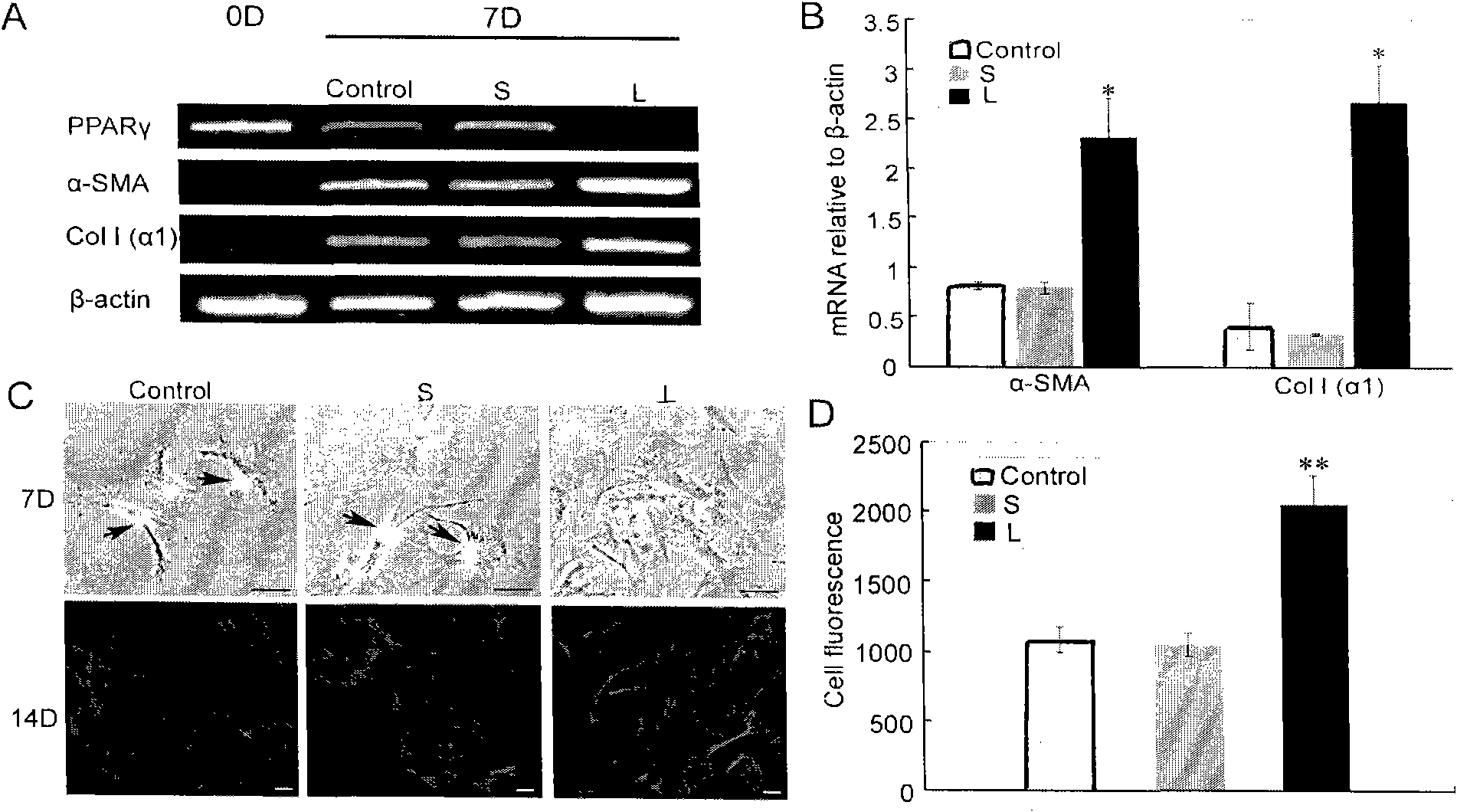 Applications of DLK1 gene, siRNA (small interference Ribonucleic Acid), BM-MSCs (Bone Marrow Mesenchymal Stem Cells) and FGF2 (Fibroblast Growth Factor2)