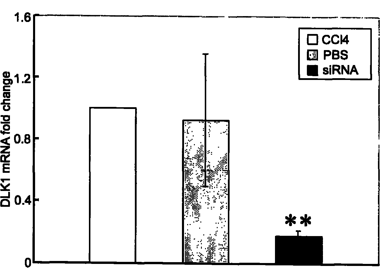 Applications of DLK1 gene, siRNA (small interference Ribonucleic Acid), BM-MSCs (Bone Marrow Mesenchymal Stem Cells) and FGF2 (Fibroblast Growth Factor2)