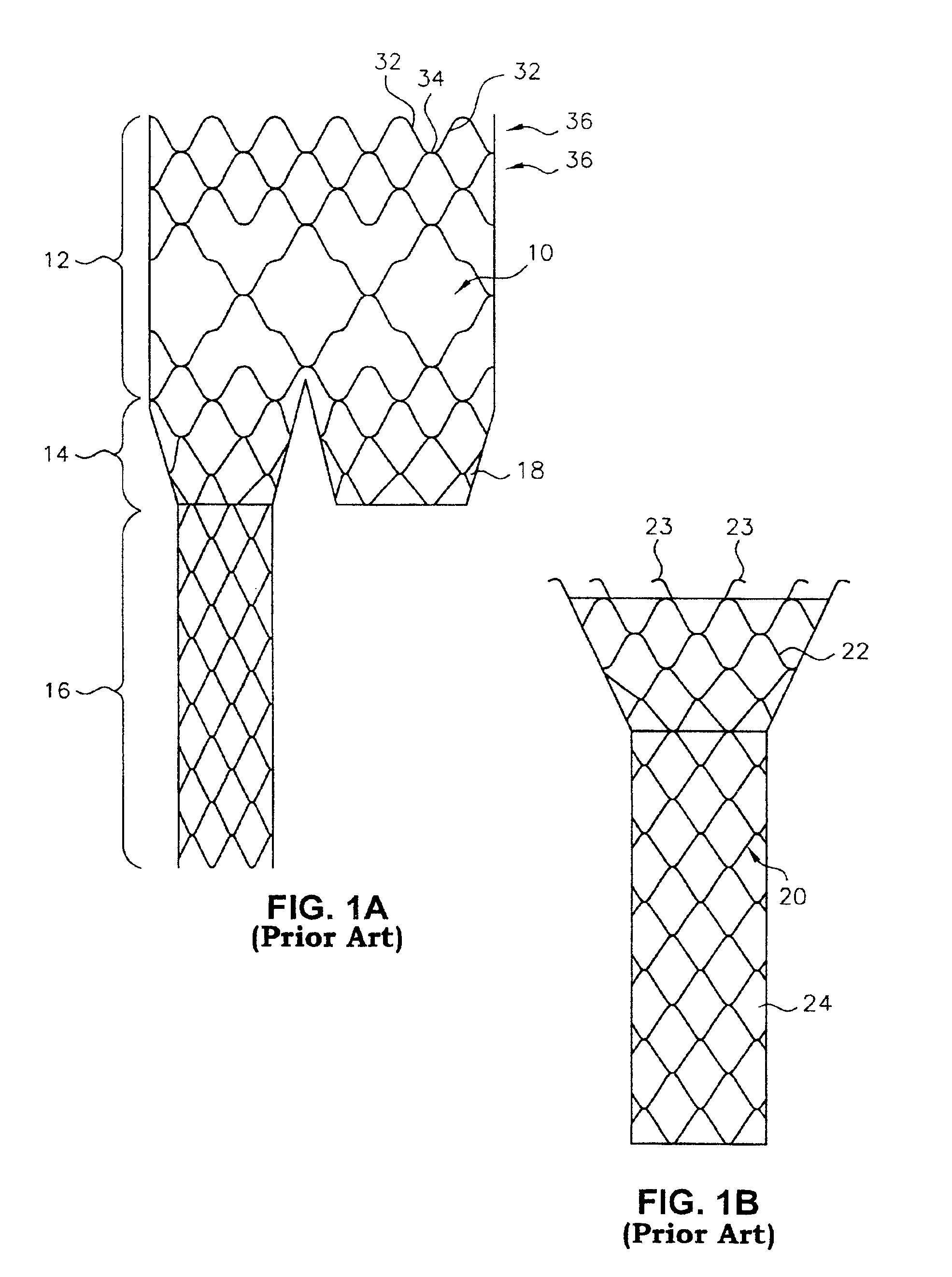 Braided branching stent, method for treating a lumen therewith, and process for manufacture thereof