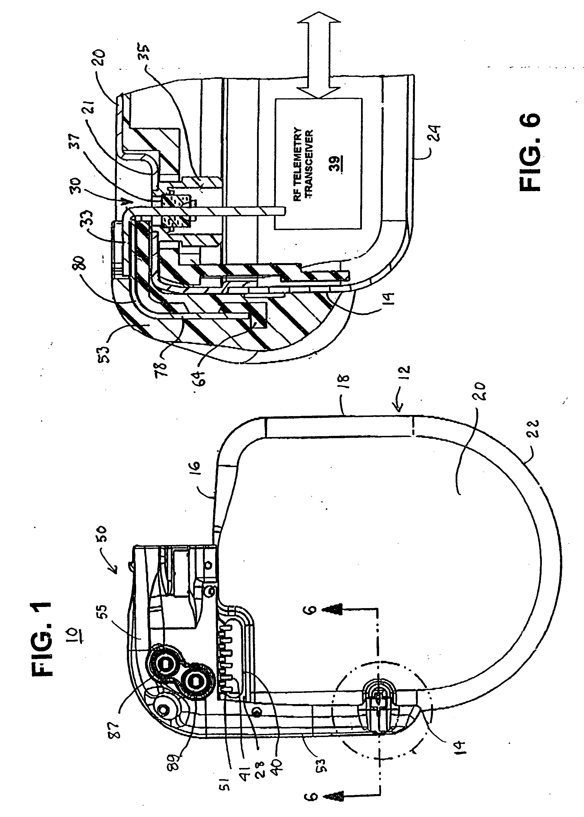 Telemetry antenna for an implantable medical device