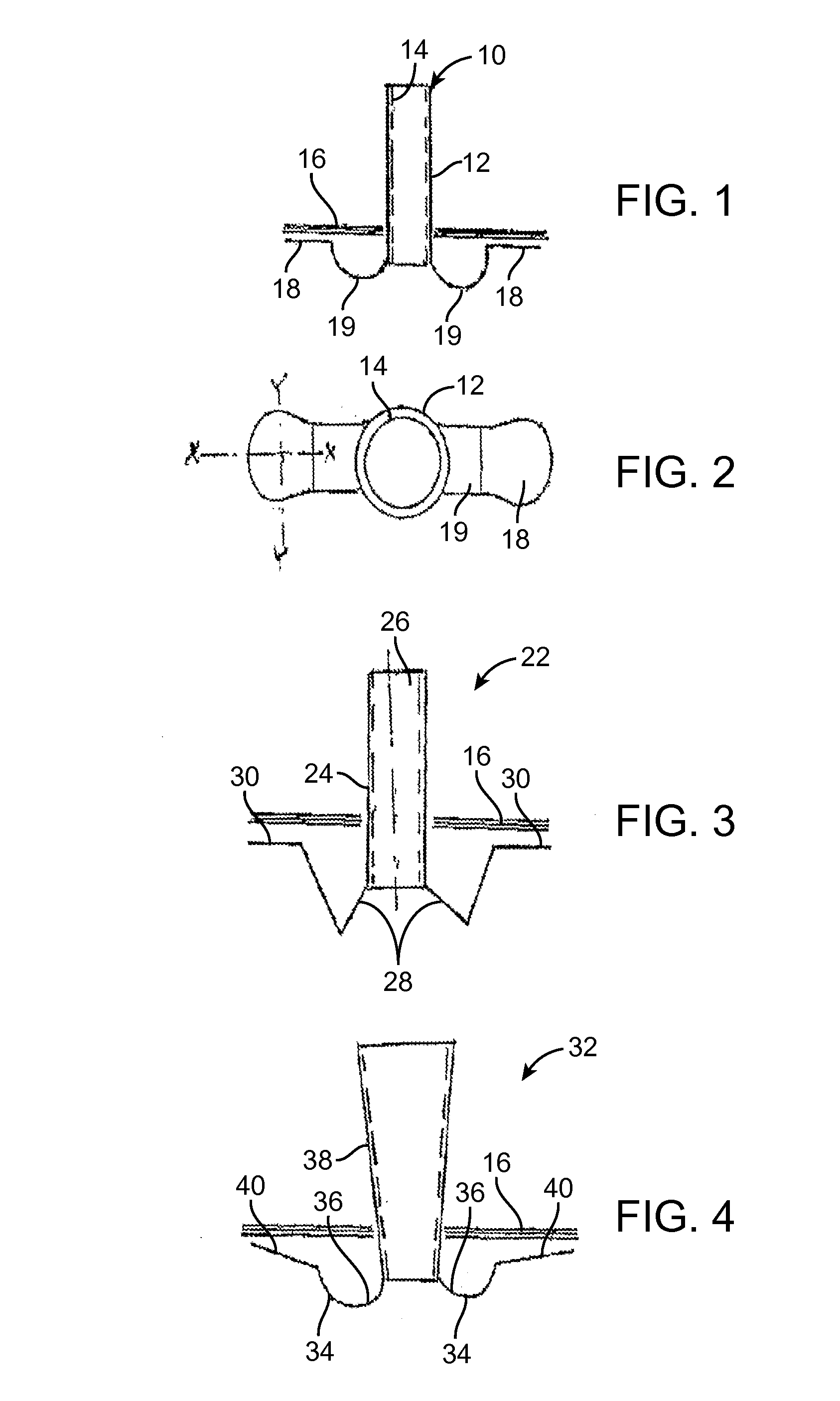 Ear tubes