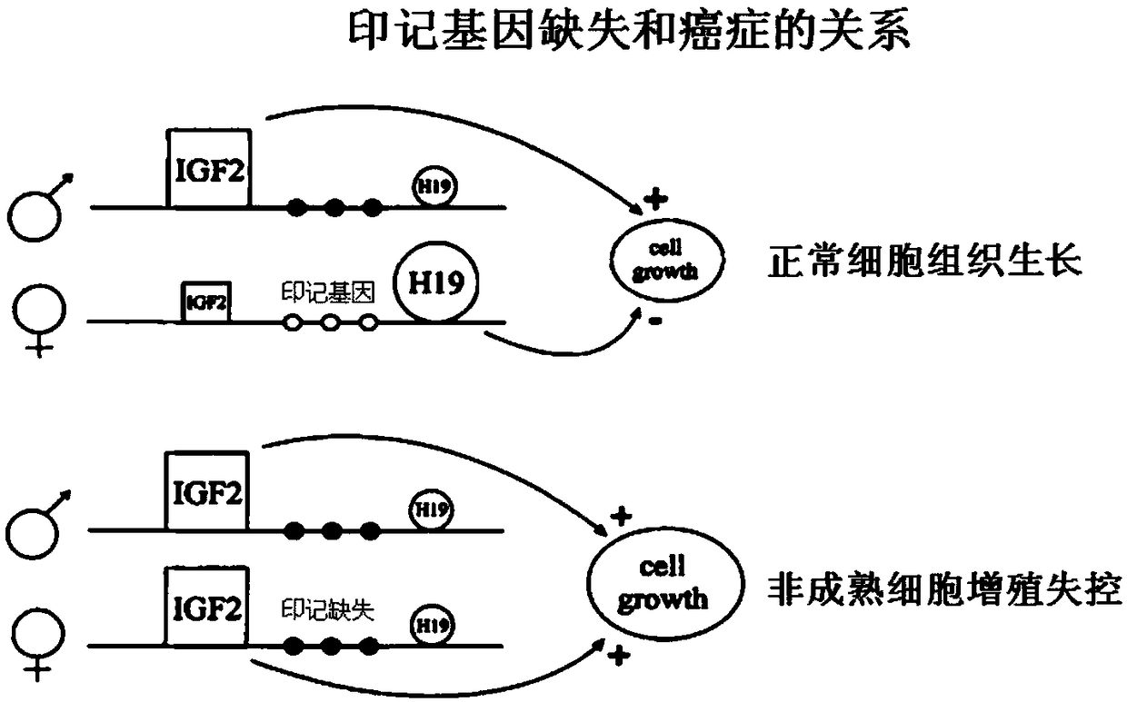 Model for detecting malignant degrees of meningioma and application of model