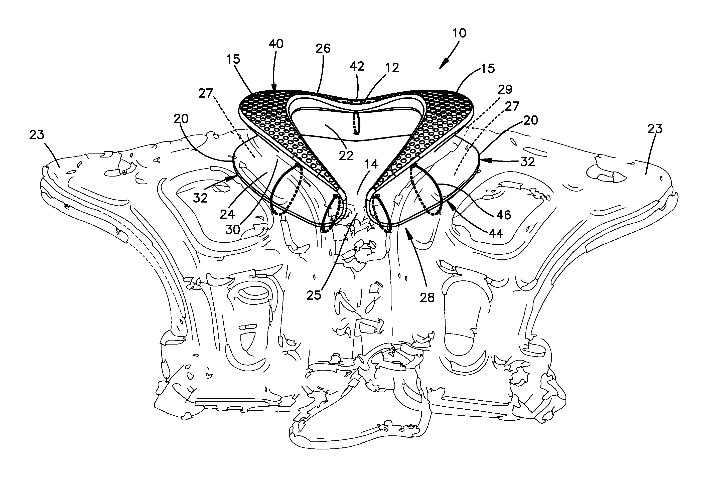 Cervical spine protection device