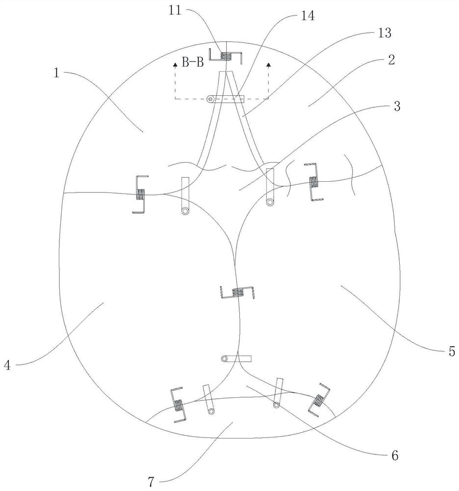 Skull structure of simulation fetus teaching aid