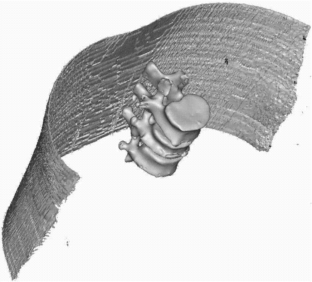 Digital location minimally invasive spine surgery 3D printing guide plate and manufacturing method