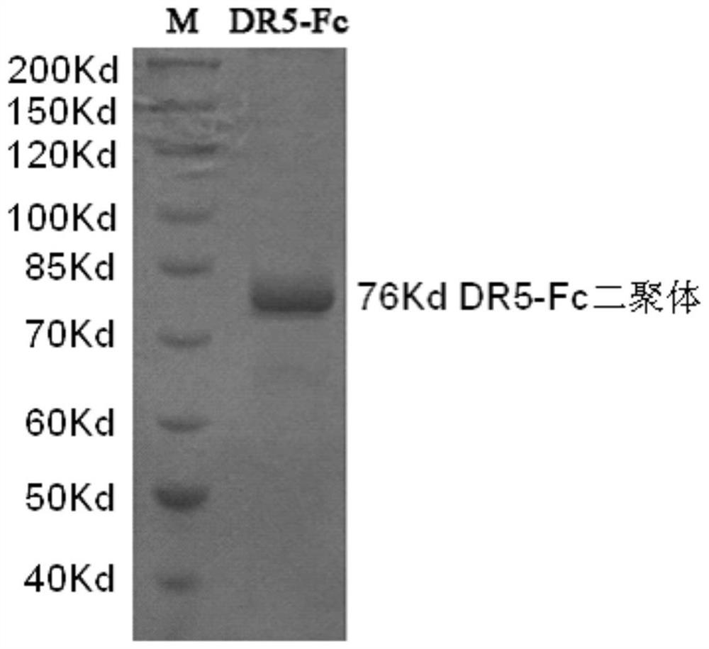 Application of human sDR5-Fc recombinant fusion protein in preparation of drugs for preventing and treating liver ischemia-reperfusion injury