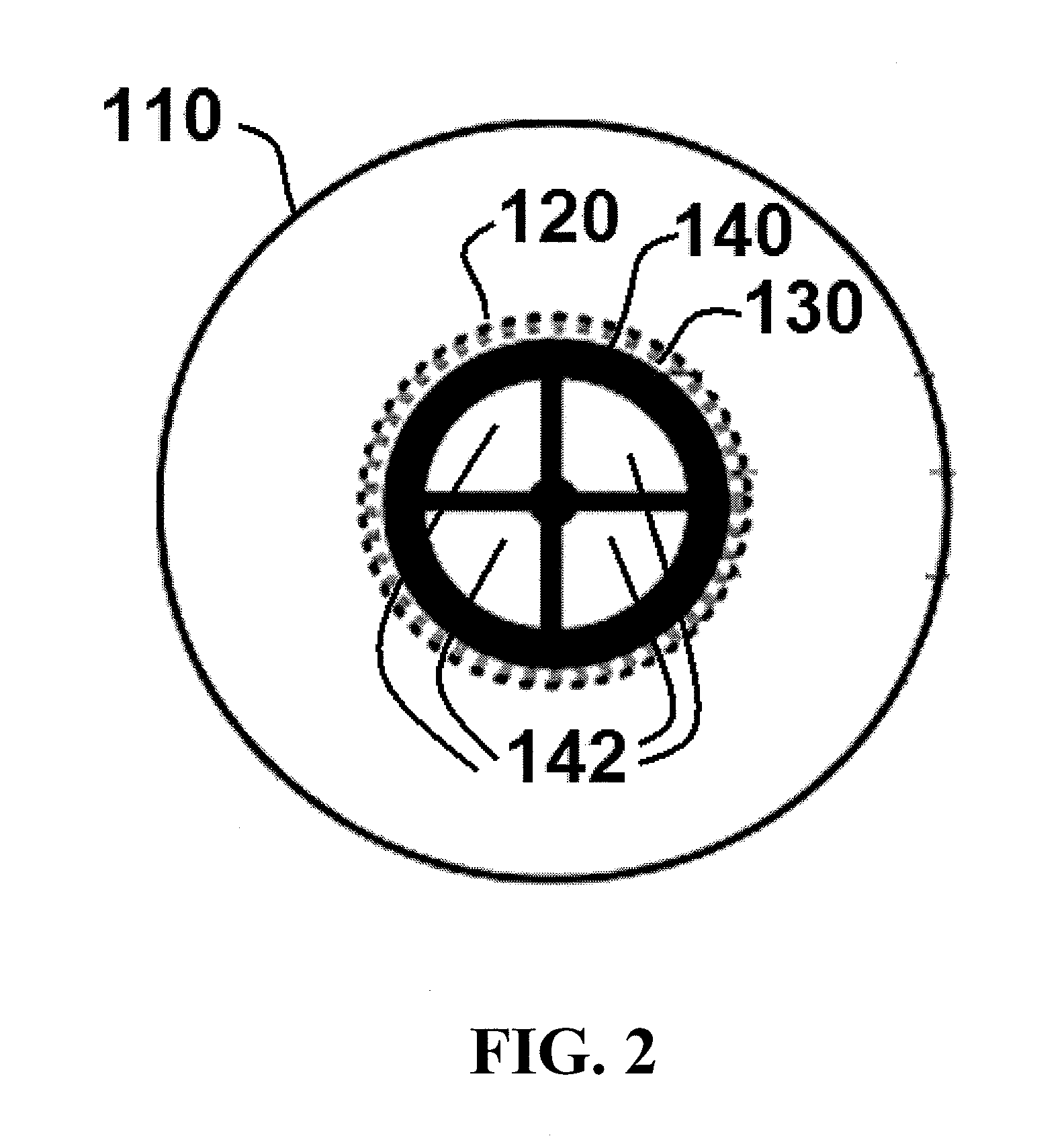 Algae filtration systems and methods