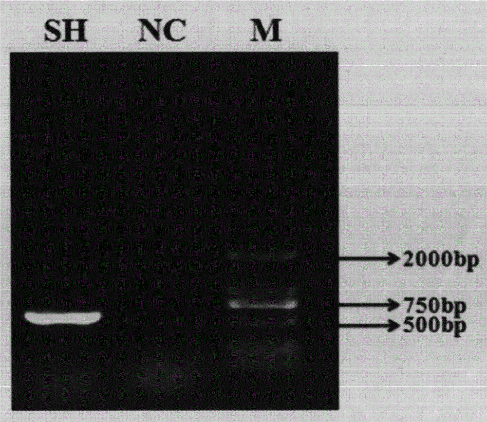 Preparation method of Yupingfeng herb residue polysaccharide synbiotic and application of synbiotic in immunoregulation