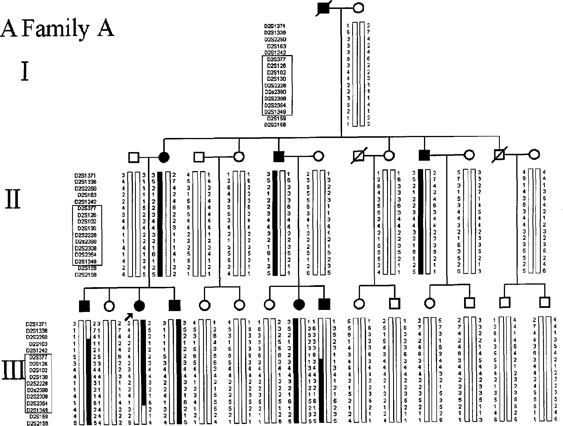 Ankylosing spondylitis pathopoiesia correlation gene IRS-1 mutant gene, detecting method and reagent kit thereof