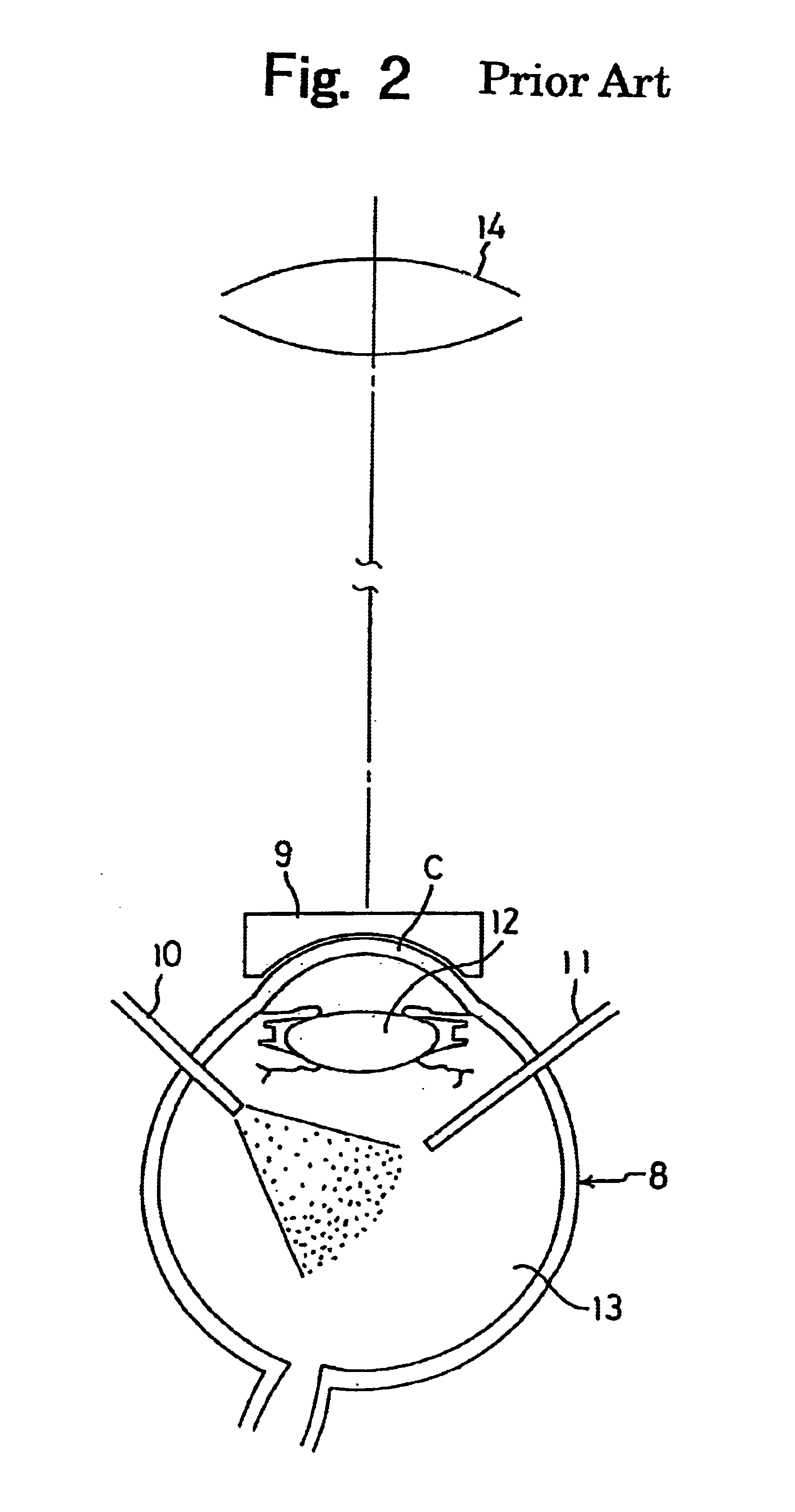 Microscope for operation