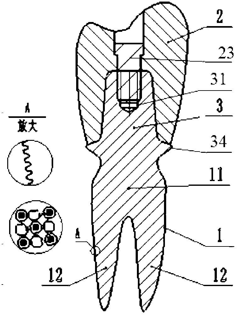 Multi-tooth-root implant for simulating natural tooth root