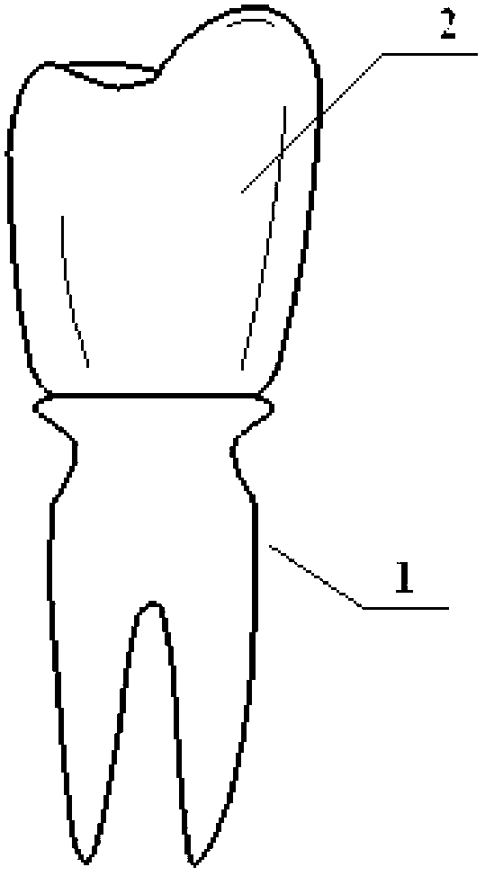 Multi-tooth-root implant for simulating natural tooth root