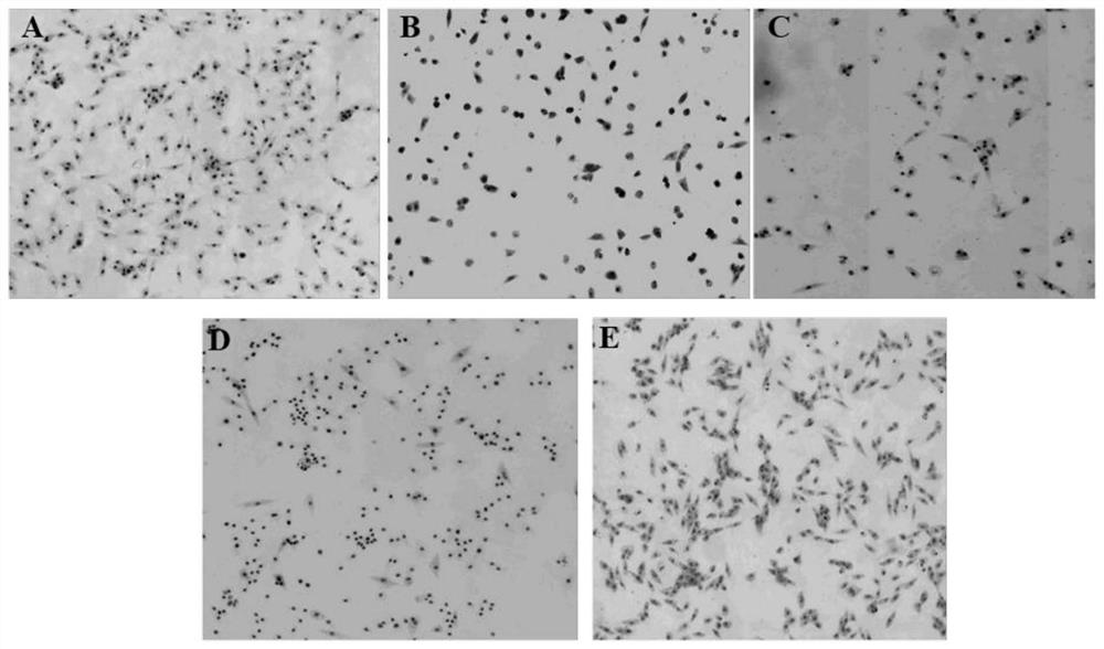 Panax notoginseng total saponin myocardial targeting liposome and preparation method thereof