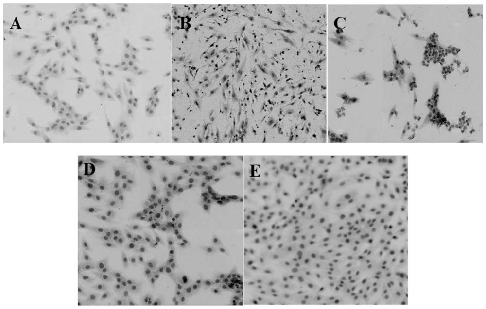 Panax notoginseng total saponin myocardial targeting liposome and preparation method thereof