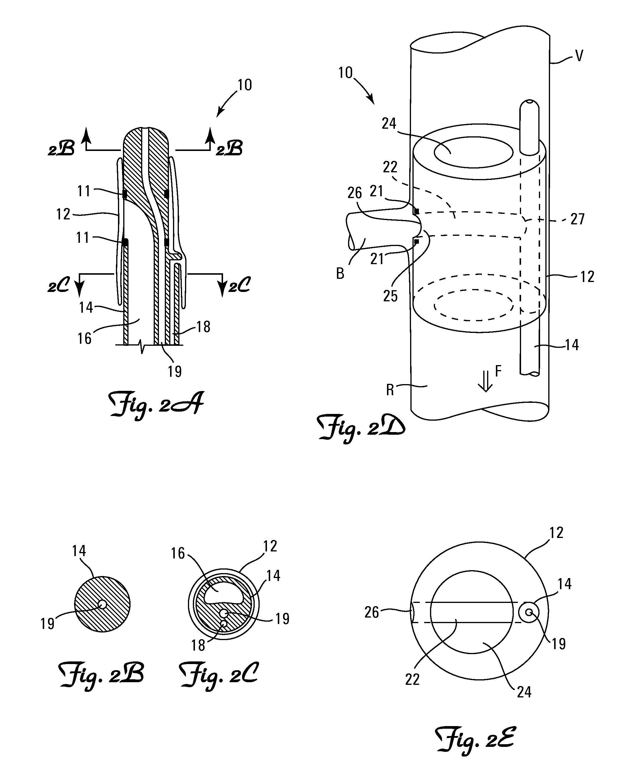 Embolic protection systems